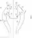 Fig. 17 - Disinfecting Methods and Apparatus