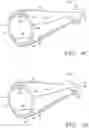Fig. 10 - Prosthetic tissue valves