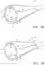 Fig. 11 - Prosthetic tissue valves