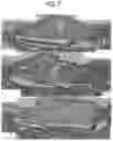 Fig. 08 - Cartilage regenerative material