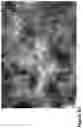 Fig. 09 - Nanofiber-hydrogel composites for enhanced soft tissue replacement and regeneration
