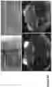 Fig. 26 - Nanofiber-hydrogel composites for enhanced soft tissue replacement and regeneration