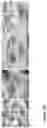 Fig. 42 - Nanofiber-hydrogel composites for enhanced soft tissue replacement and regeneration