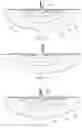Fig. 22 - Wound treatment apparatus and method