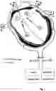 Fig. 02 - TOTAL HEART ASSISTANCE DEVICE