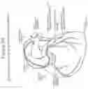 Fig. 04 - Devices and methods for modulating medium delivery
