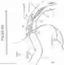 Fig. 12 - Devices and methods for modulating medium delivery