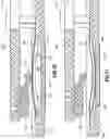 Fig. 10 - Liquid medicament reservoir empty detection sensor and occlusion sensor for medicament delivery device