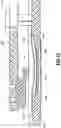 Fig. 11 - Liquid medicament reservoir empty detection sensor and occlusion sensor for medicament delivery device