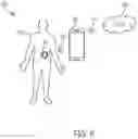Fig. 04 - Drug delivery system with sensor having optimized communication and infusion site