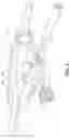 Fig. 08 - Endoscopic cannula