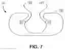 Fig. 11 - Endoscopic cannula