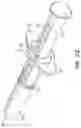 Fig. 13 - Endoscopic cannula