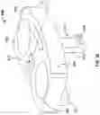 Fig. 31 - Attachment band for a fluid delivery apparatus and method of use