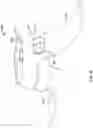 Fig. 40 - Attachment band for a fluid delivery apparatus and method of use