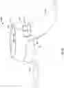 Fig. 41 - Attachment band for a fluid delivery apparatus and method of use