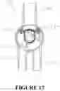 Fig. 14 - Apparatus and method for a lung isolation tube assembly