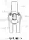 Fig. 16 - Apparatus and method for a lung isolation tube assembly