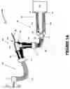Fig. 02 - Catheter mount with suction port