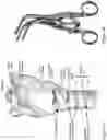 Fig. 02 - Percutaneous dilation tracheostomy device and method of using