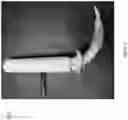 Fig. 03 - Percutaneous dilation tracheostomy device and method of using
