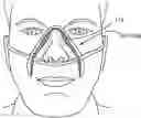 Fig. 01 - IMPROVEMENTS FOR RESPIRATORY MASKS