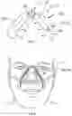 Fig. 05 - IMPROVEMENTS FOR RESPIRATORY MASKS