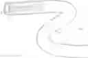 Fig. 01 - ADJUSTABLE CALIBER CATHETER SYSTEM