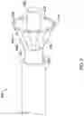 Fig. 03 - AORTO OSTIAL FLUID DIRECTING DEVICE