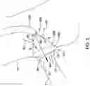 Fig. 06 - AORTO OSTIAL FLUID DIRECTING DEVICE