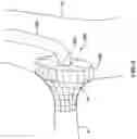 Fig. 07 - AORTO OSTIAL FLUID DIRECTING DEVICE