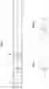 Fig. 03 - Guidewire