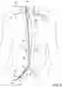 Fig. 06 - Devices for transvascular retrograde access placement