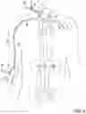 Fig. 09 - Devices for transvascular retrograde access placement