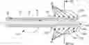 Fig. 01 - Devices for delivering a chemical denervation agent and methods of use