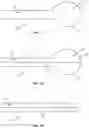 Fig. 02 - Devices for delivering a chemical denervation agent and methods of use