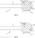Fig. 06 - Devices for delivering a chemical denervation agent and methods of use