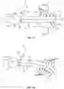 Fig. 11 - Devices for delivering a chemical denervation agent and methods of use