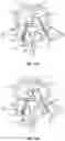 Fig. 16 - Devices for delivering a chemical denervation agent and methods of use