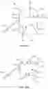 Fig. 17 - Devices for delivering a chemical denervation agent and methods of use
