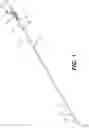 Fig. 02 - DEVICE FOR OCCLUSION ISOLATION AND REMOVAL