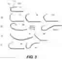 Fig. 04 - DEVICE FOR OCCLUSION ISOLATION AND REMOVAL