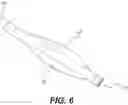 Fig. 07 - DEVICE FOR OCCLUSION ISOLATION AND REMOVAL