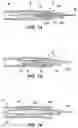 Fig. 11 - Exoskeleton device with expandable section for scoring