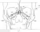 Fig. 01 - Catheter systems and methods for medical procedures using catheters