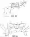Fig. 03 - Catheter systems and methods for medical procedures using catheters