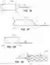 Fig. 05 - Catheter systems and methods for medical procedures using catheters