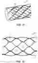 Fig. 06 - Catheter systems and methods for medical procedures using catheters