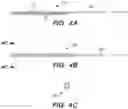 Fig. 07 - Catheter systems and methods for medical procedures using catheters
