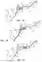 Fig. 15 - Catheter systems and methods for medical procedures using catheters